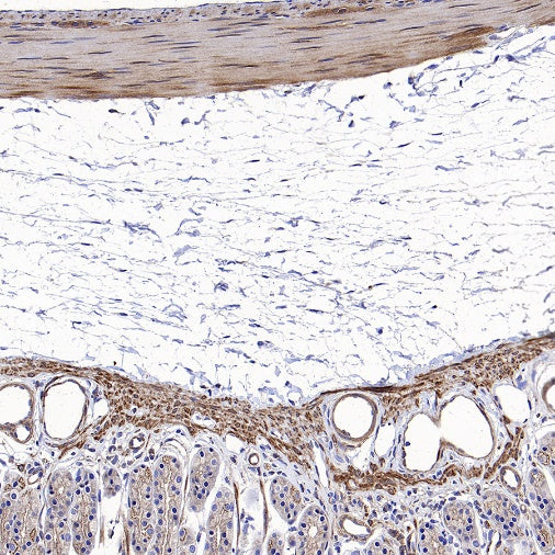 Vinculin Recombinant Rabbit mAb (S-1635-3)