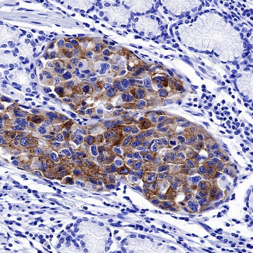FGFR2b Recombinant Rabbit mAb (SDT-423-121)