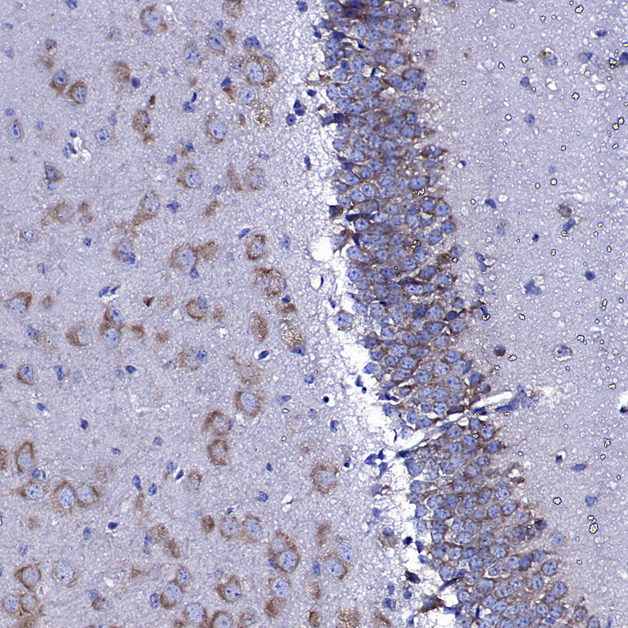 Upf1 Rabbit Polyclonal Antibody