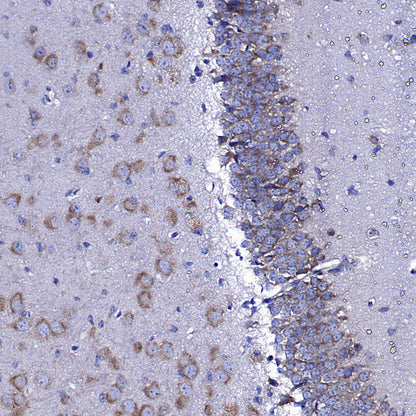 Upf1 Rabbit Polyclonal Antibody