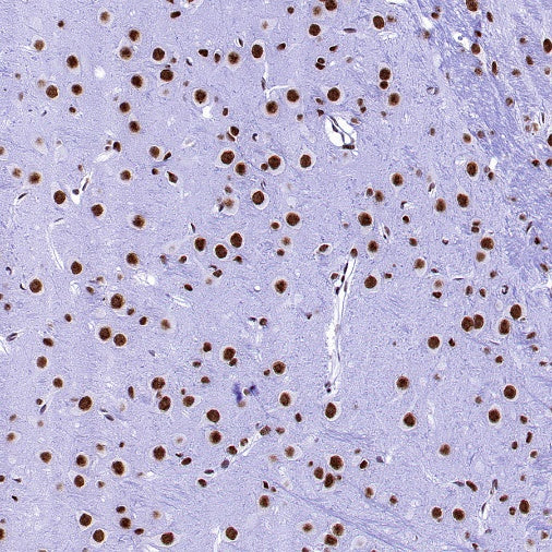 U2AF1 Recombinant Rabbit mAb (S-2384)