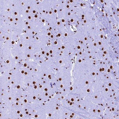 U2AF1 Recombinant Rabbit mAb (S-2384)