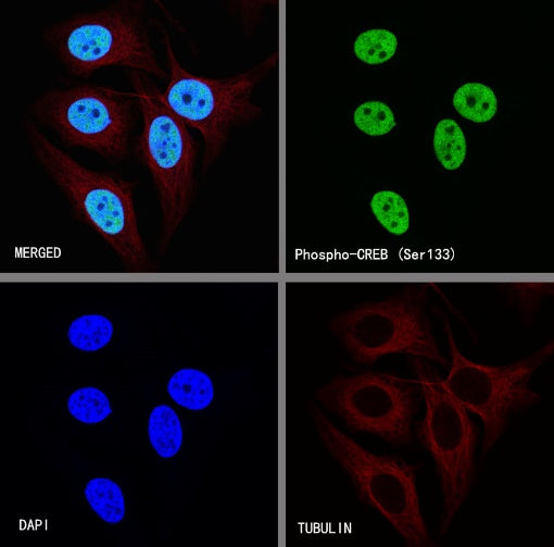 CREB Recombinant Rabbit mAb (S-747-60)