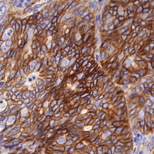 B7-H3 Recombinant Rabbit mAb (SDT-249-26)