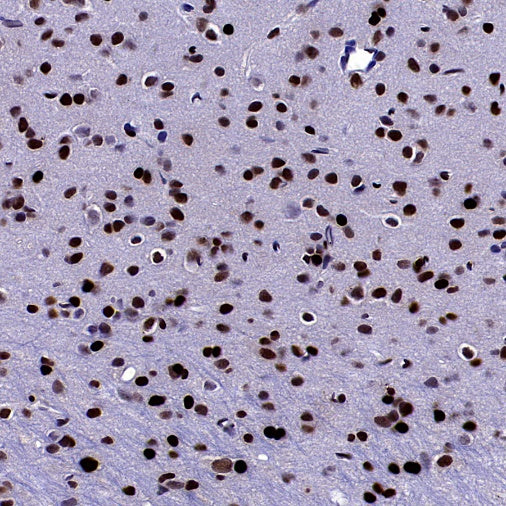DLX5 Recombinant Rabbit mAb (S-2785-79)