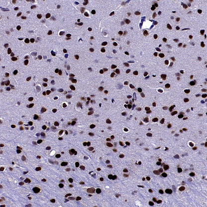 DLX5 Recombinant Rabbit mAb (S-2785-79)