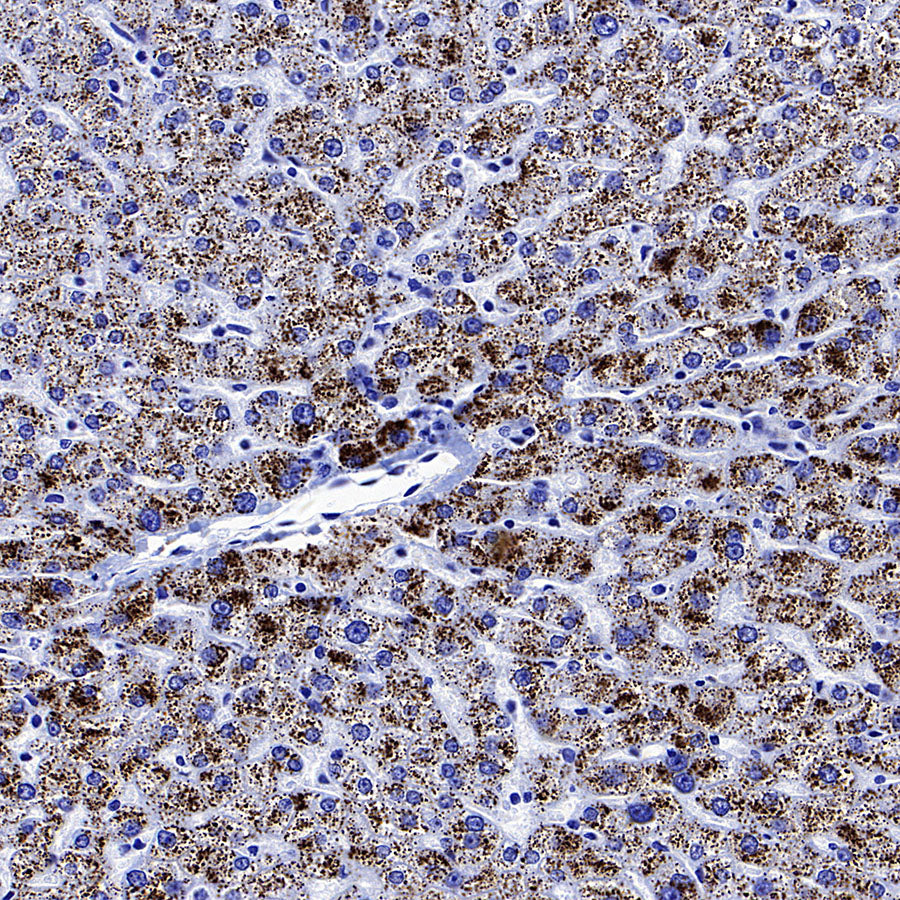 AGXT Recombinant Rabbit mAb (S-3586-30)