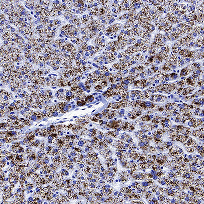 AGXT Recombinant Rabbit mAb (S-3586-30)