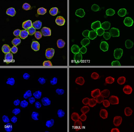 BTLA/CD272 Recombinant Rabbit mAb (S-742-13-2)