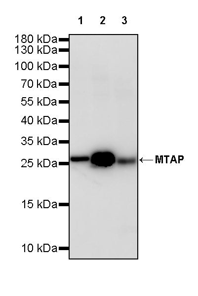 MTAP Recombinant Rabbit mAb (S-813-23)