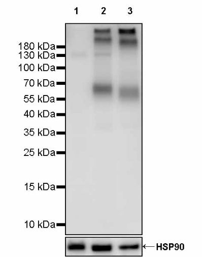 KCND2 Recombinant Rabbit mAb (S-3102-32)