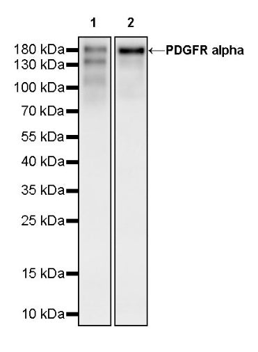 PDGFR alpha Recombinant Rabbit mAb (SDT-3353)