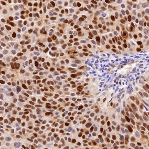 PCNA Recombinant Rabbit mAb (SDT-297-116)