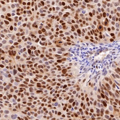 PCNA Recombinant Rabbit mAb (SDT-297-116)