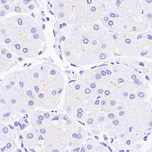 Pericentrin Recombinant Rabbit mAb (S-3493)