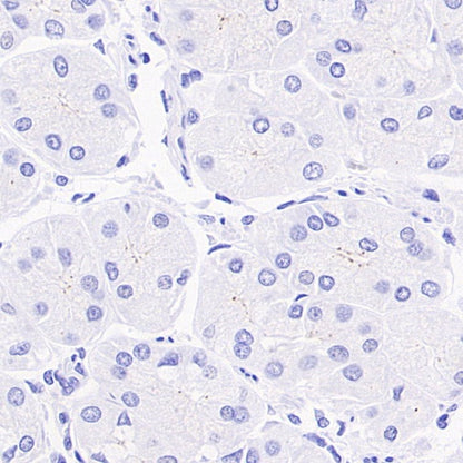 Pericentrin Recombinant Rabbit mAb (S-3493)