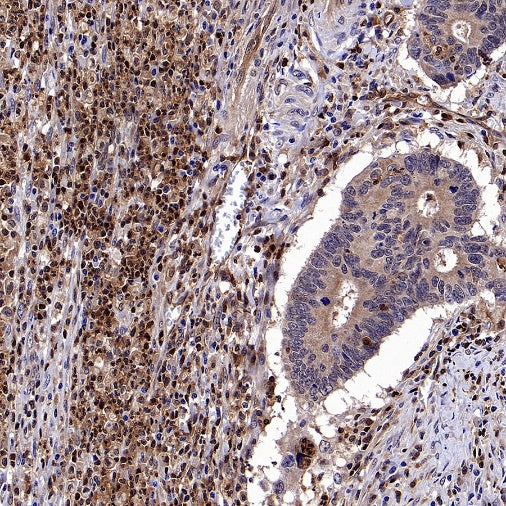 Stat5 Recombinant Rabbit mAb (S-2823-24)