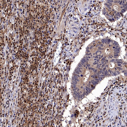 Stat5 Recombinant Rabbit mAb (S-2823-24)