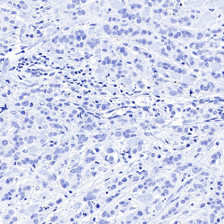STEAP1+STEAP1B1+STEAP1B2 Recombinant Rabbit mAb (S-3226-137)