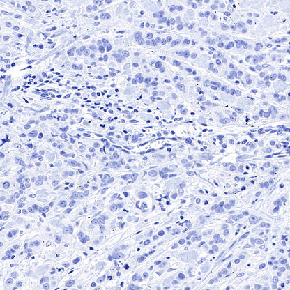 STEAP1+STEAP1B1+STEAP1B2 Recombinant Rabbit mAb (S-3226-137)