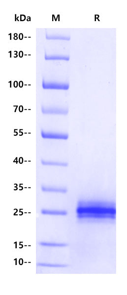 Cynomolgus IL-6 Protein, His Tag