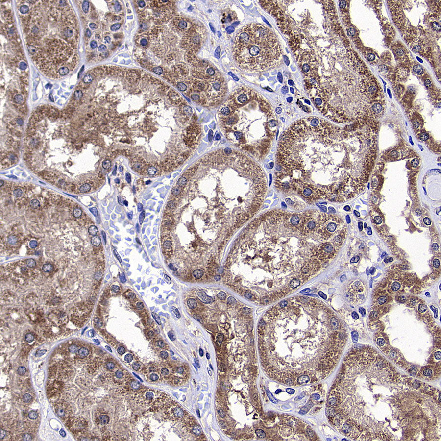 TXNRD1 Mouse mAb (S-M0053)