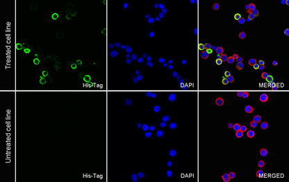 His tag Recombinant Rabbit mAb (S-5315)