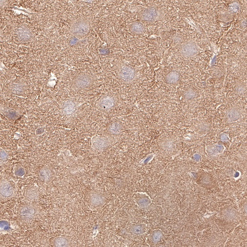 PKM Recombinant Rabbit mAb (S-812-20)