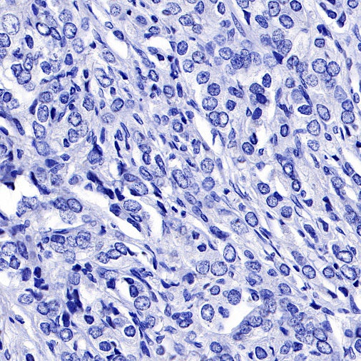 PMEL/Melanoma gp100 Recombinant Rabbit mAb (SDT-434-70)
