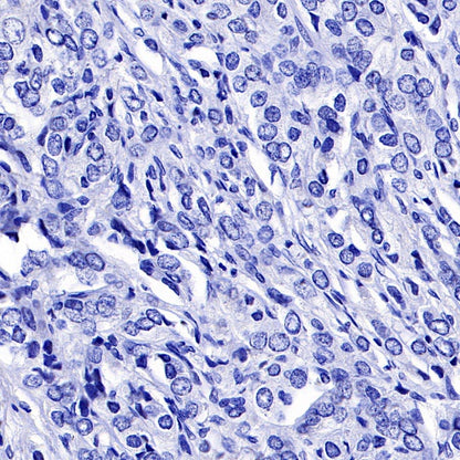 PMEL/Melanoma gp100 Recombinant Rabbit mAb (SDT-434-70)