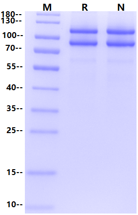UAF1&USP1 Complex His&Flag Tag Protein, Human