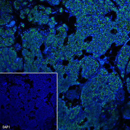 PTH Recombinant Rabbit mAb (SDT-407-4)