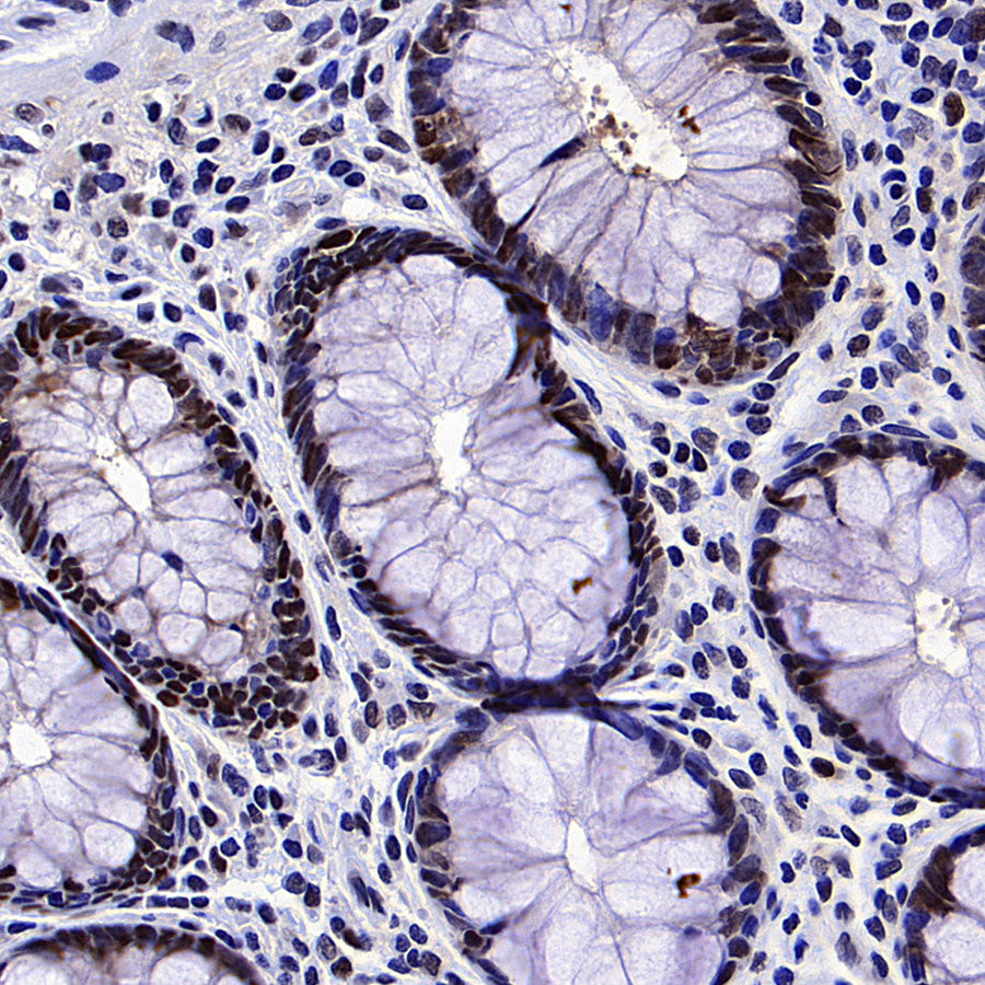 PCNA Recombinant Mouse mAb (S-5477)