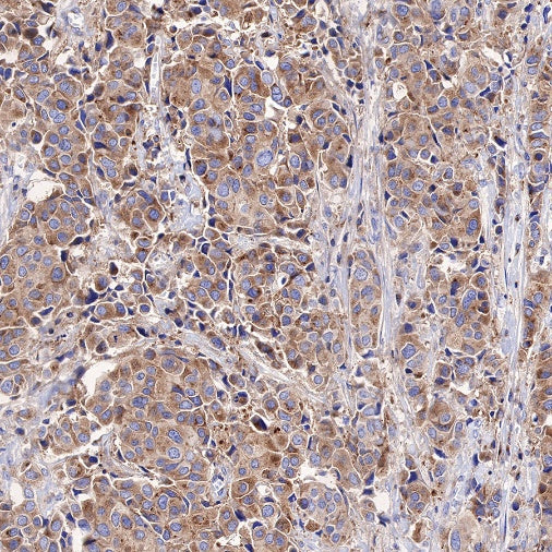 KRAS Recombinant Rabbit mAb (S-443-69)