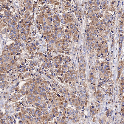 KRAS Recombinant Rabbit mAb (S-443-69)