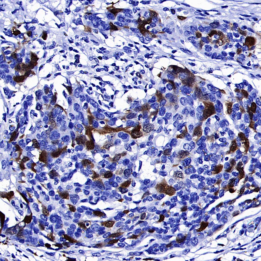 Thymidine Kinase 1 Recombinant Rabbit mAb (S-4127-43)