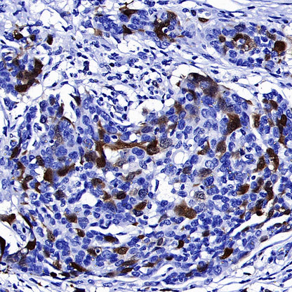 Thymidine Kinase 1 Recombinant Rabbit mAb (S-4127-43)