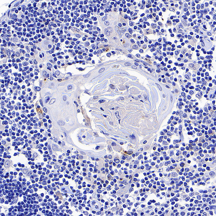 4-1BB/CD137/TNFRSF9 Recombinant Rabbit mAb (S-4989)