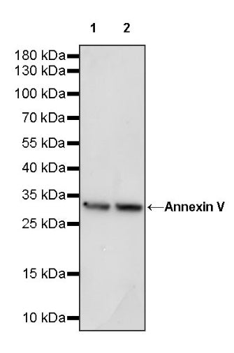 Annexin V Recombinant Rabbit mAb (S-1395-41)