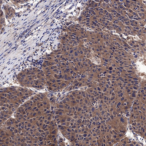 Atg5 Recombinant Rabbit mAb (SDT-456-9)