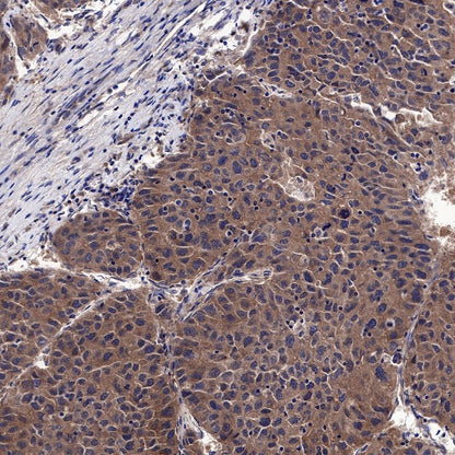 Atg5 Recombinant Rabbit mAb (SDT-456-9)