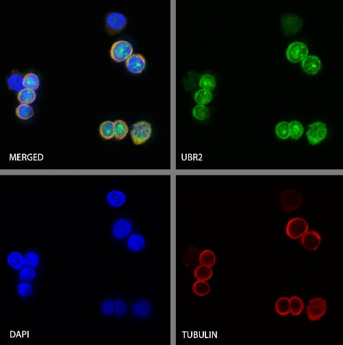 UBR2 Recombinant Rabbit mAb (S-2041-163)