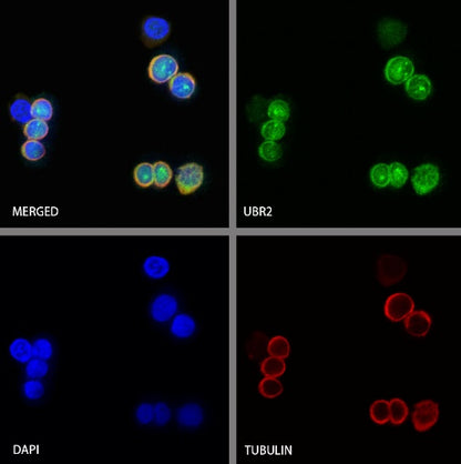 UBR2 Recombinant Rabbit mAb (S-2041-163)