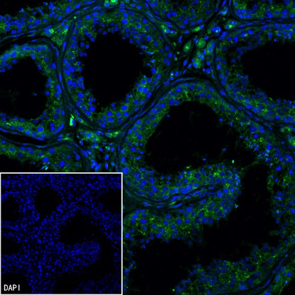 M6PR Recombinant Rabbit mAb (S-2348-14)