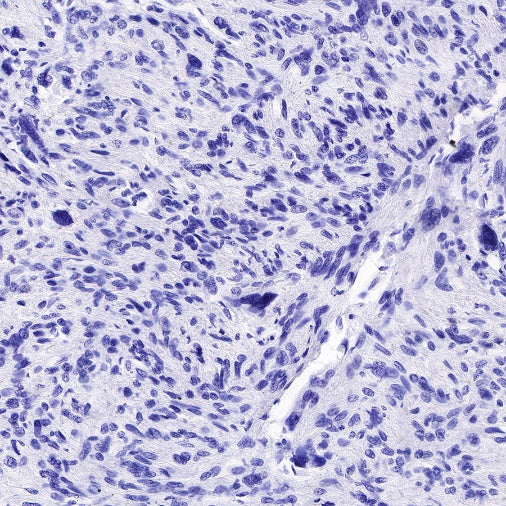 MUC4 Recombinant Rabbit mAb (SDT-841-13)