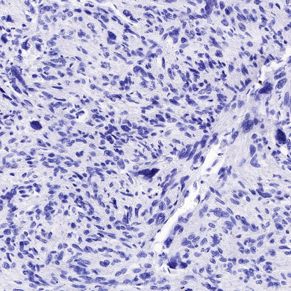 MUC4 Recombinant Rabbit mAb (SDT-841-13)
