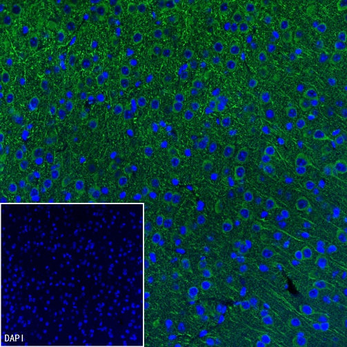MAP2 Recombinant Rabbit mAb (SDT-2060-28)