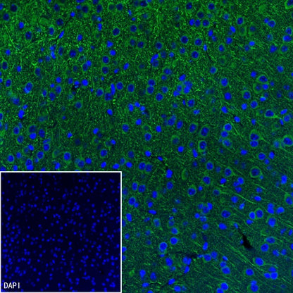 MAP2 Recombinant Rabbit mAb (SDT-2060-28)