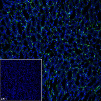 Nestin Recombinant Rabbit mAb (S-5471)
