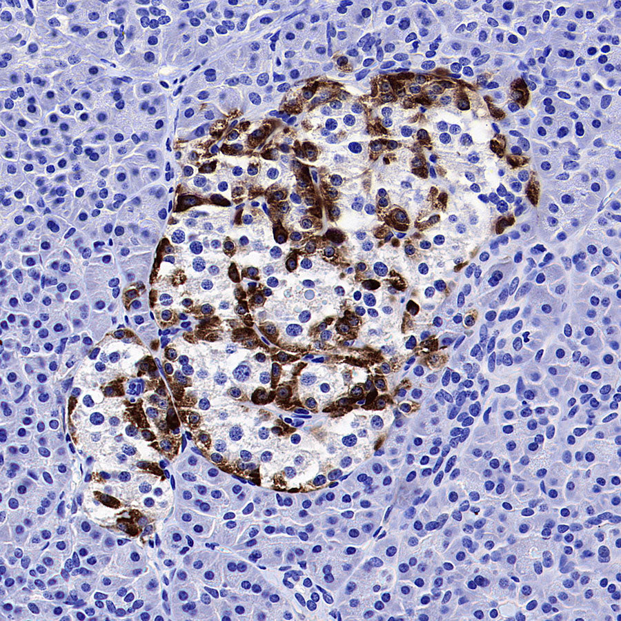 Fibroblast Activation Protein alpha/FAP Recombinant Rabbit mAb (S-3998-2)